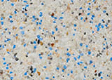 Pool Finishes